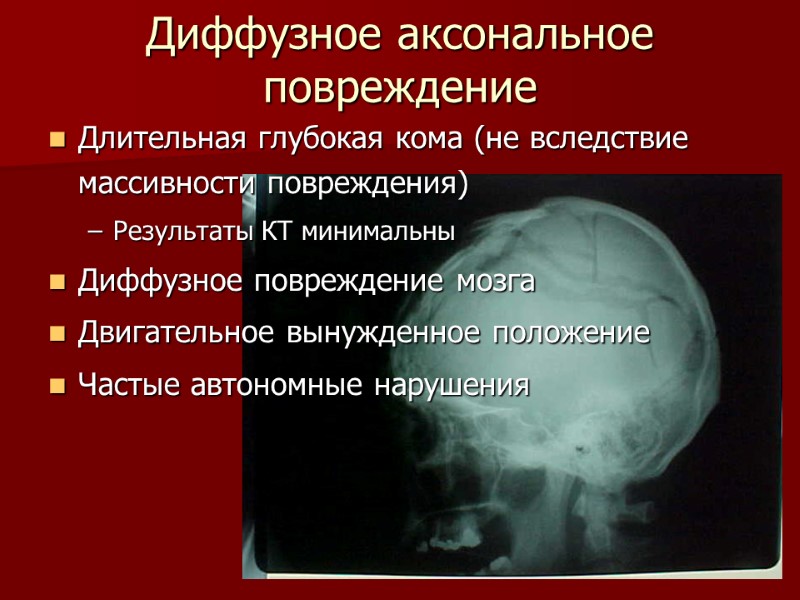 Диффузное аксональное повреждение Длительная глубокая кома (не вследствие массивности повреждения) Результаты КТ минимальны Диффузное